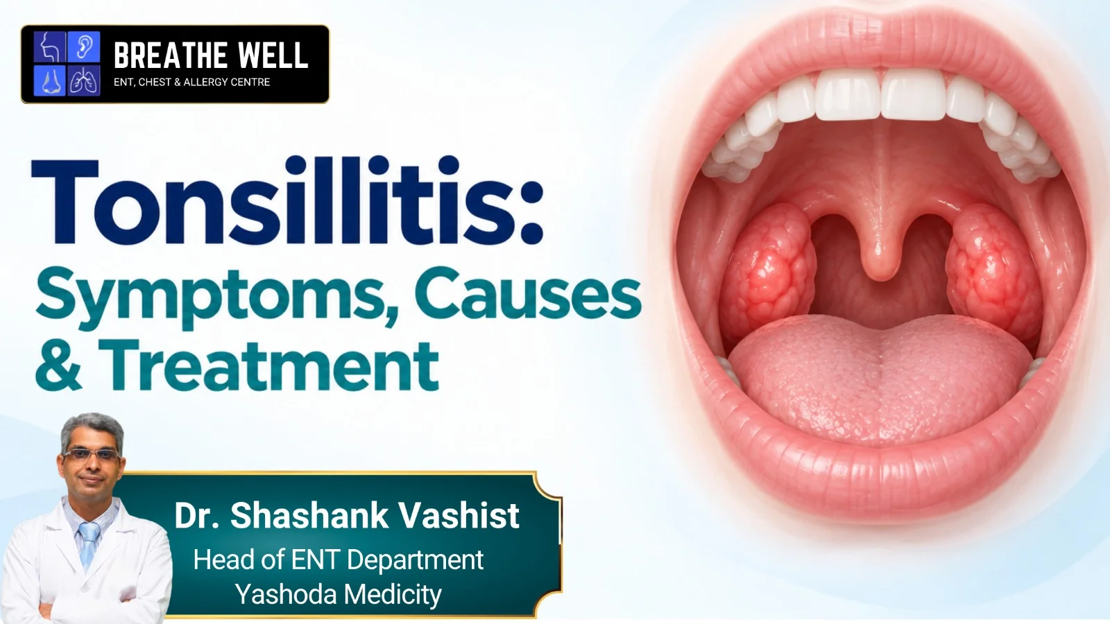 Tonsillitis: Symptoms, Causes & Treatment